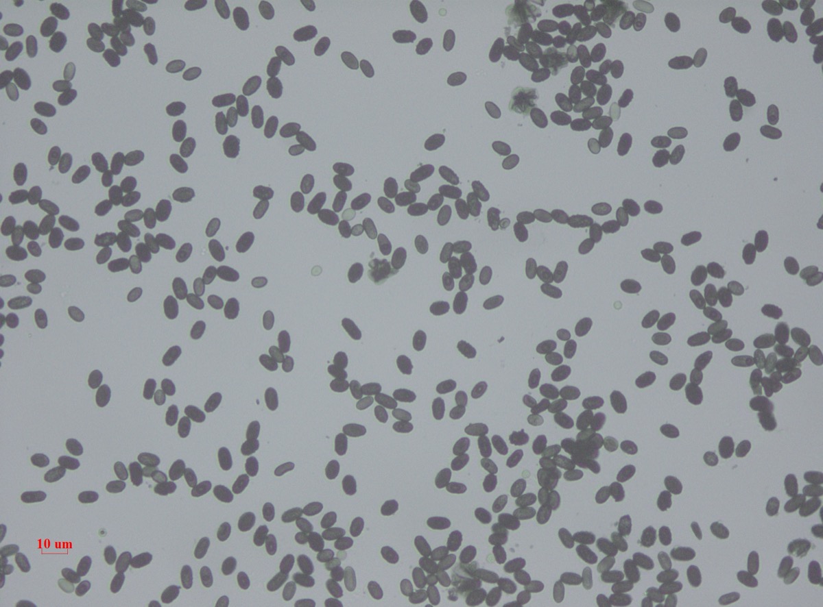 Stachybotrys mold spores — the type commonly associated with sustained moisture and water damage